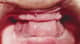Slider image (10) Smiletec® - Leading Mexicali Dental Clinic